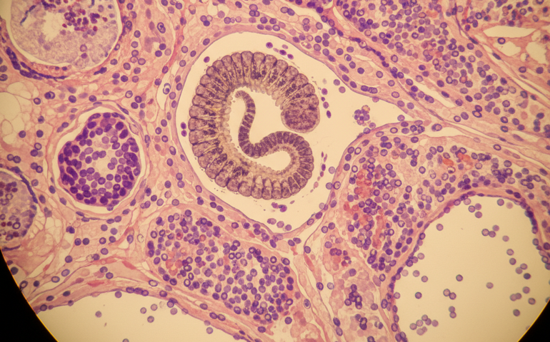 Parasita nunca antes visto em seres humanos é motivo de infecção pulmonar em mulher