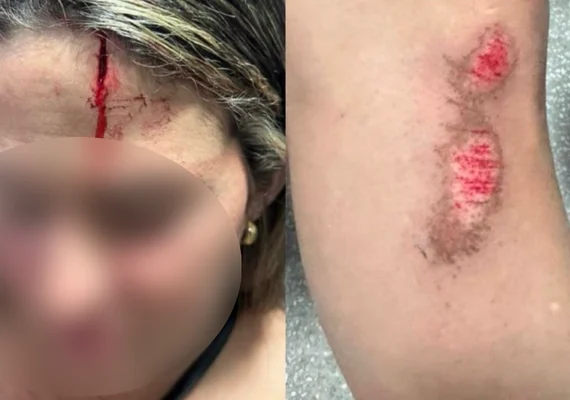 Mulher é atropelada e agredida pelo ex-companheiro no Sertão