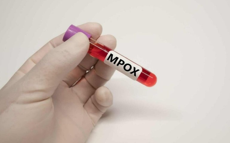 OMS faz alerta sobre 'enxurrada' de informações falsas sobre mpox