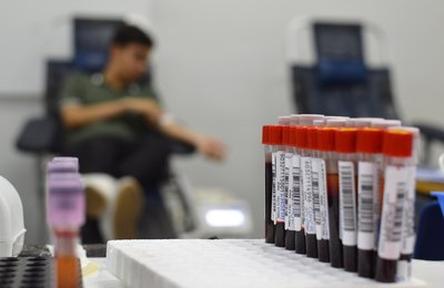 Fadiga persistente é sinal de alerta para doença grave nas células do sangue