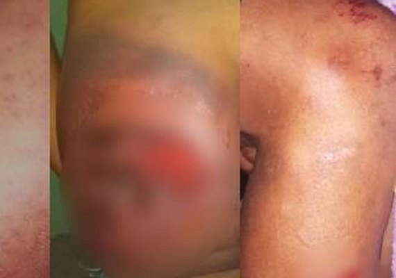 Guarda Municipal é acusada de agressão em São José da Laje