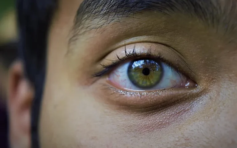 Qual a cor de olhos mais comum? E a mais rara?