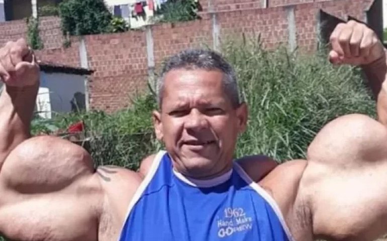 Morre Arlindo de Souza, o 'Popeye Brasileiro', aos 55 anos
