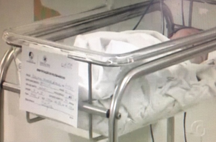Cirurgia cardíaca inédita em bebê de AL recebe destaque em reportagem