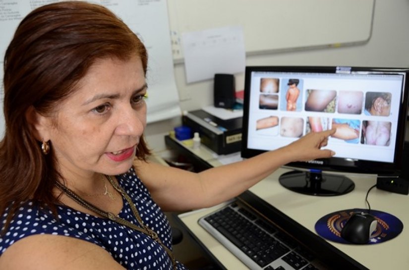 Campanha para combate às verminoses e hanseníase avança em Alagoas