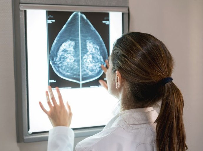 SUS amplia acesso à mamografia a mulheres de 40 a 49 anos