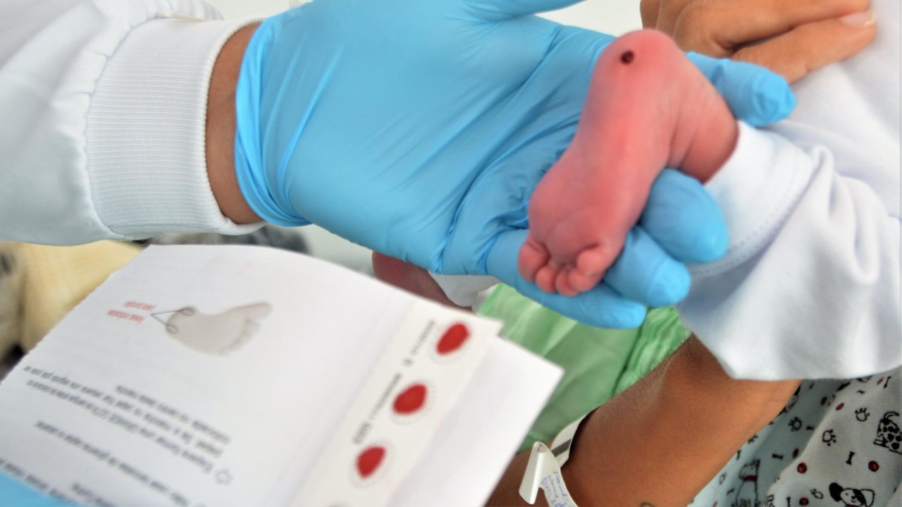 Dia do Teste do Pezinho: Pediatra da Sesau ressalta a importância do exame para diagnosticar doenças precocemente