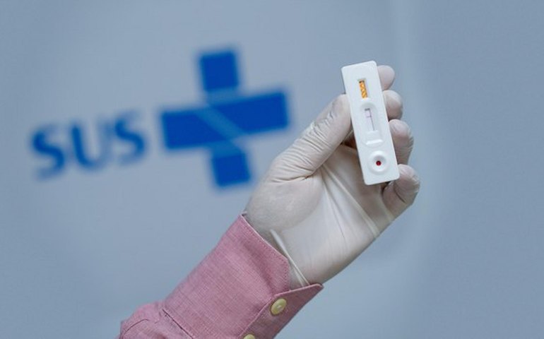 UPAs vinculadas à Secretaria de Saúde oferecem teste rápido para detecção da Covid-19