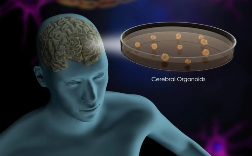 Pesquisadores utilizam 'mini cérebros' para novas descobertas sobre o autismo