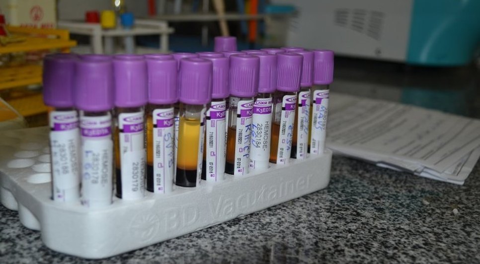 DOAÇÃO DE SANGUE HEMOSE / Foto: Ascom/SES