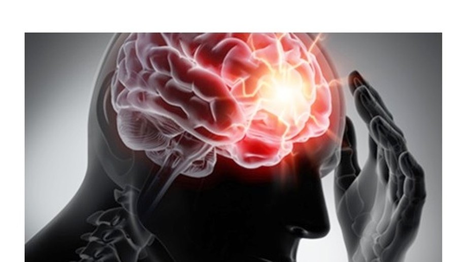 Concussão cerebral