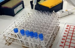 Saúde anuncia medidas para ampliar tratamento de hepatites no SUS