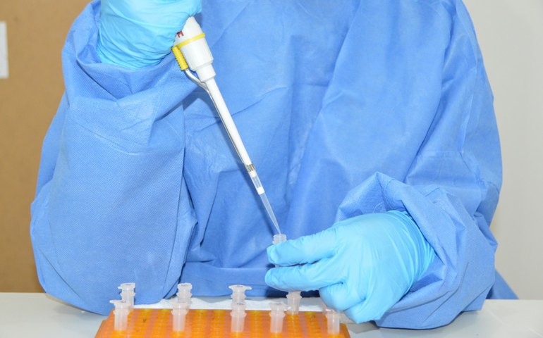 Sesau confirma 1º caso de varíola dos macacos (Monkeypox) em Alagoas