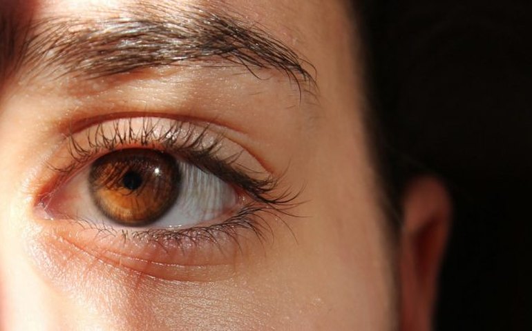Fotofobia: entenda o que é, quais os sintomas e como tratar