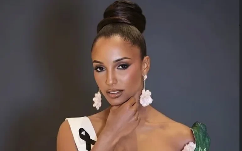 Miss Jamaica permanece na UTI após acidente durante o Miss Universo