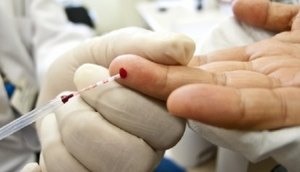 teste-sangue-HIV-aids--eex5p2615413-f3.jpg