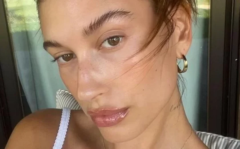 Hailey Bieber revela cisto no ovário “do tamanho de uma maçã”
