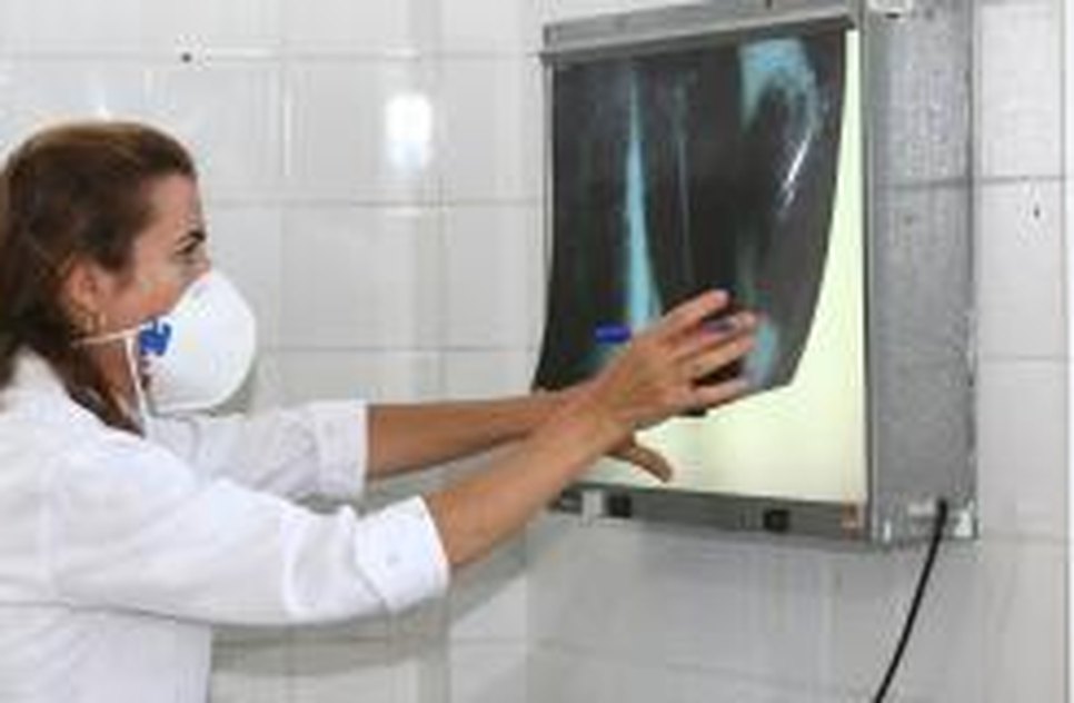 tuberculose.jpg