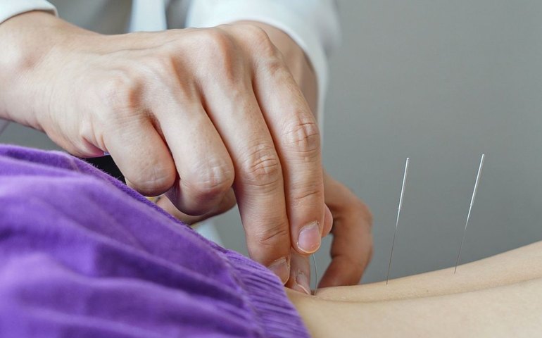 Brasil regulamenta exercício profissional da acupuntura