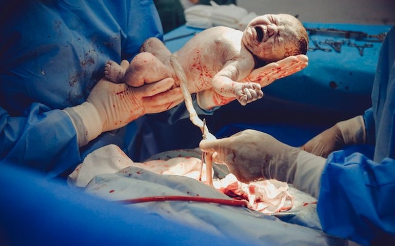 Brasil é o 9º país com mais partos prematuros no mundo