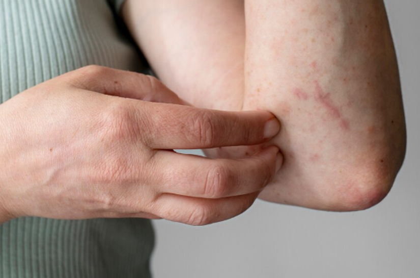 Veterinário alerta para os cuidados com a esporotricose, infecção fúngica comum em gatos, que tem crescido entre os tutores