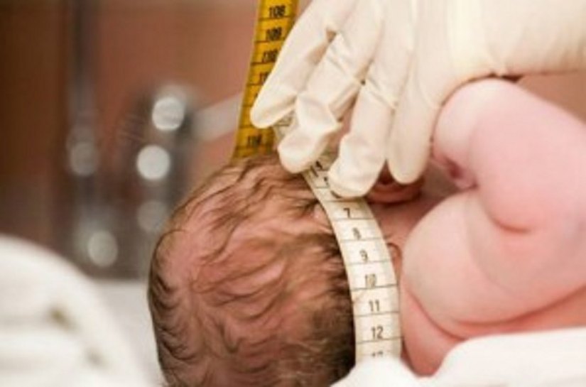 Maceió: 24 casos de microcefalia podem ter relação com zika vírus