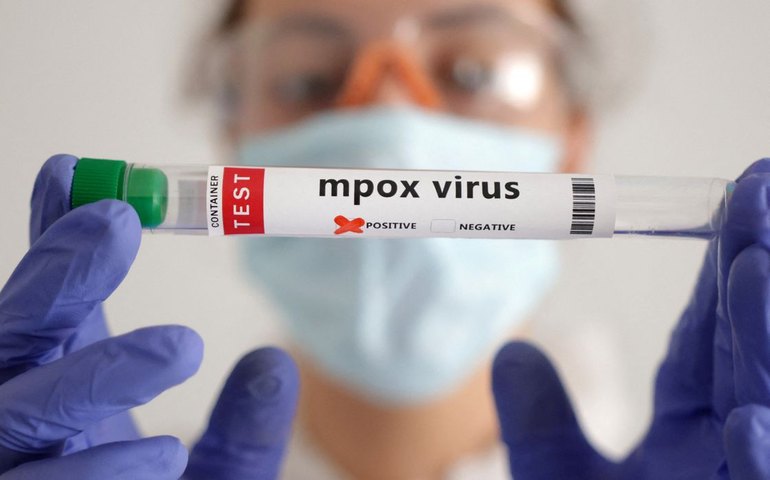 Brasil supera marca de mil casos de mpox em 2024