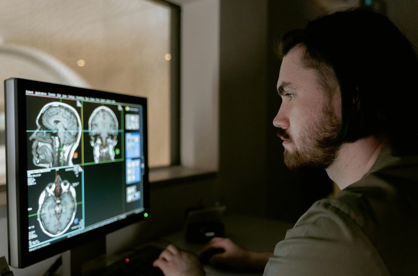 Maio Cinza: sinais de tumor cerebral vão além da dor de cabeça