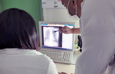 Hospital Helvio Auto implanta novo esquema que reduz tempo de tratamento para tuberculose latente