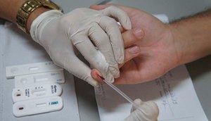 Aracaju realiza testagem para identificação de HIV e doenças sexualmente transmissíveis; confira locais