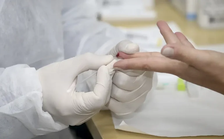 Teste rápido na detecção da febre bubônica é avaliado em campo