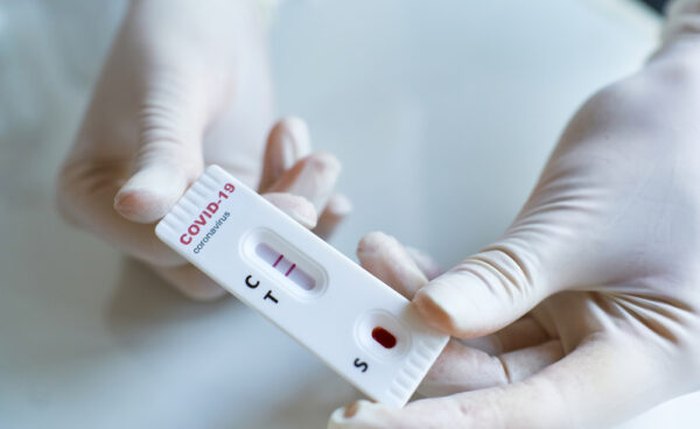 Teste para detecção do coronavírus