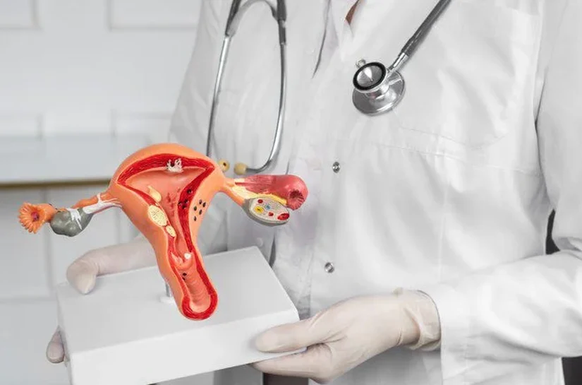 União amplia atendimento do SUS a mulheres com endometriose profunda