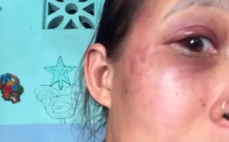 Mulher denuncia companheiro por agressão após recusar relação sexual no Tabuleiro do Martins, em Maceió