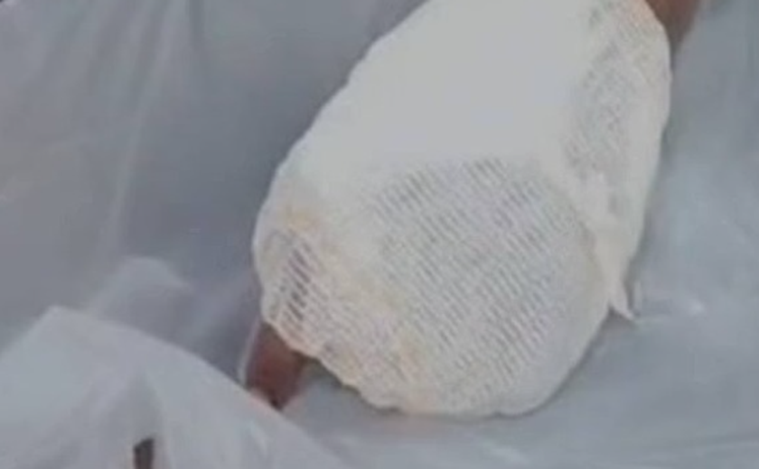 Homem é baleado na mão ao tentar se proteger de disparo em Formosa (GO); suspeito é preso em flagrante