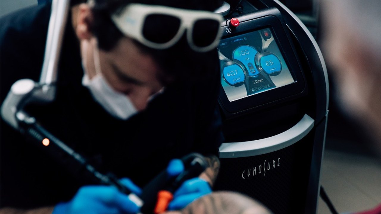 Remoção de tatuagens exige cuidados especiais