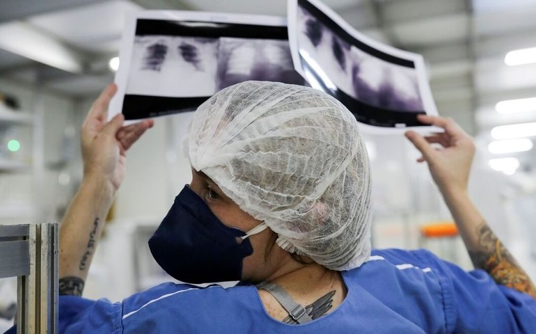 Covid-19 causa aumento de síndrome respiratória grave em 7 estados