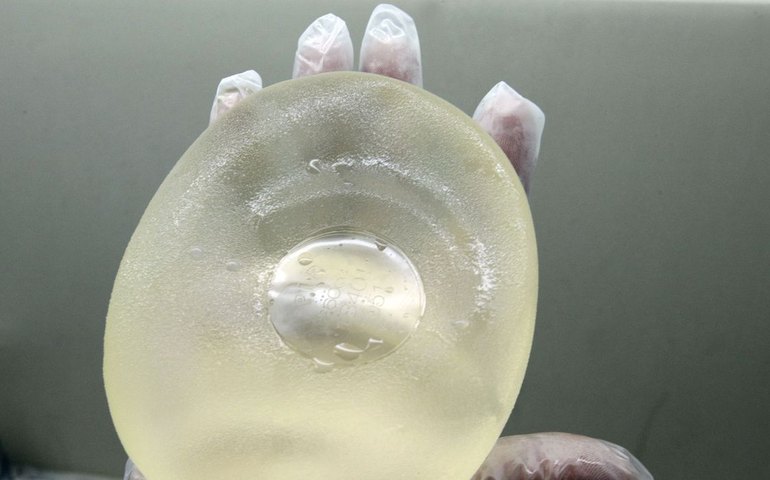 'Dama do bumbum' é condenada a pena mínima de 15 anos por morte de atriz após aplicação de silicone na Califórnia