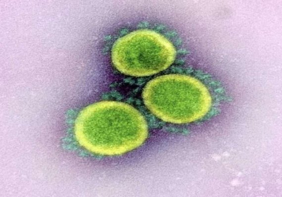 Variante 'Nimbus' da COVID-19 se espalha nos EUA com sintoma incomum: dor de garganta extrema