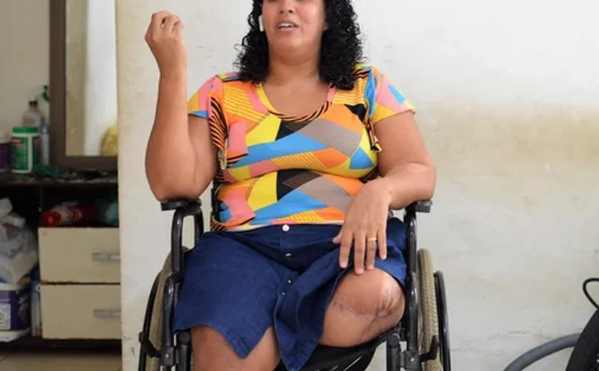 Trabalhadora que perdeu a perna em acidente de moto na Rota do Mar é se recupera no HGE