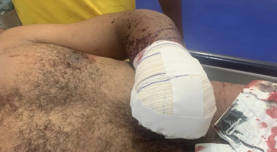 Homem tem mão decepada com facão durante discussão em Itabaianinha / Foto: Foto: Polícia Militar/Divulgação