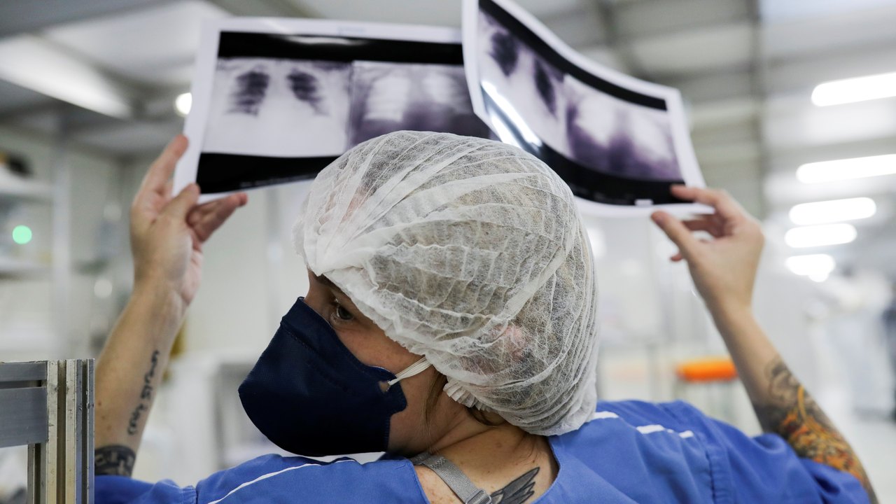 Diagnóstico tardio dá poucas chances de cura para o câncer de pulmão