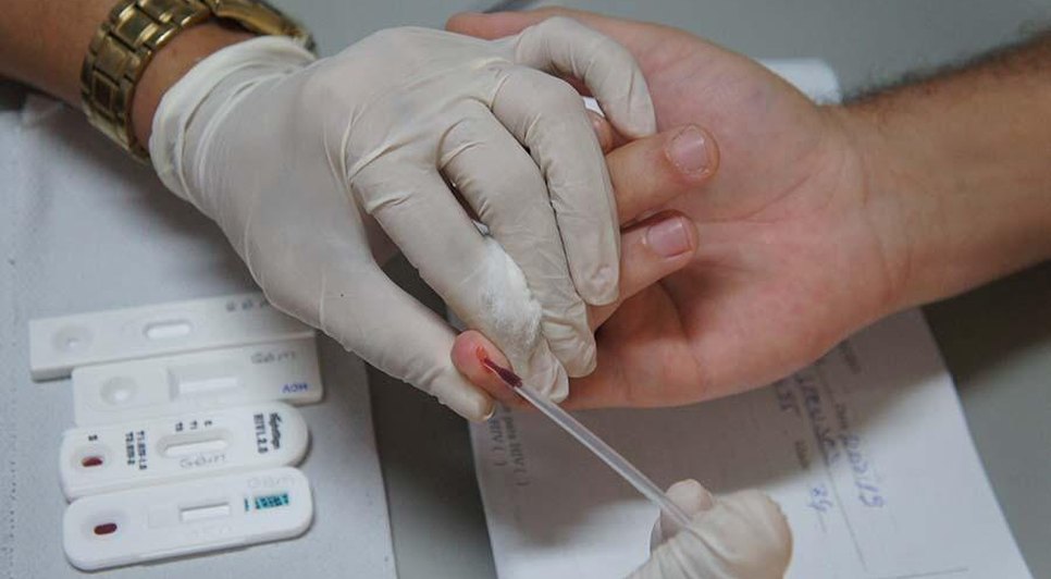 Aracaju realiza testagem para identificação de HIV e doenças sexualmente transmissíveis; confira locais