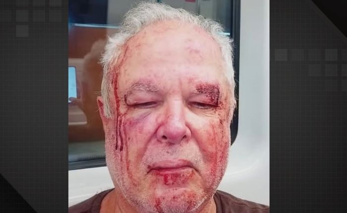 Idoso é agredido após ser visto com propaganda de político da esquerda