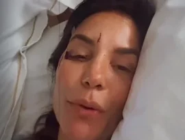 Ivete Sangalo relata susto de saúde e tranquiliza fãs: “Desmaiei, mas estou bem”