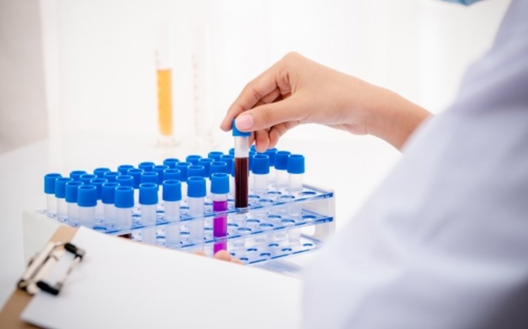 Técnico em Análises Clínicas: conheça a importância deste profissional nas UPAs de Maceió