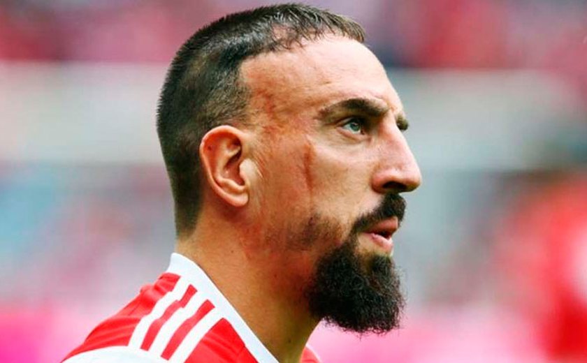 Ribery volta a se machucar e só retorna aos gramados em 2016