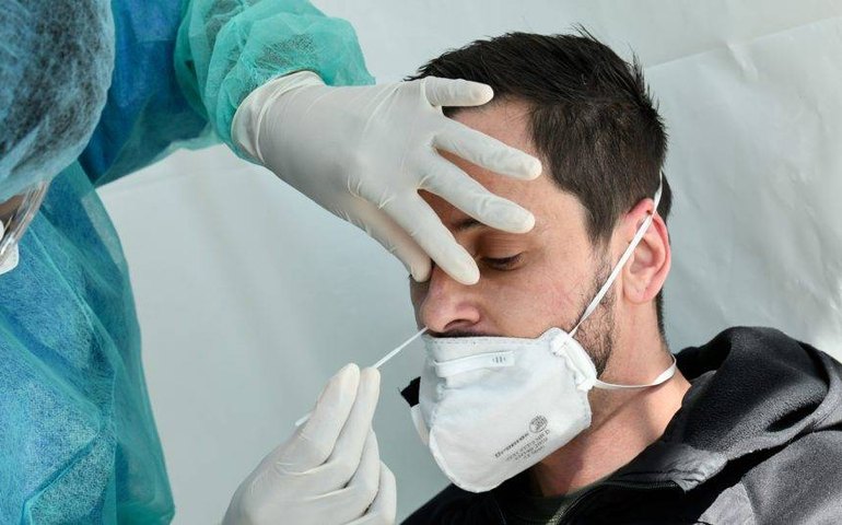 Brasil terá 46 milhões de testes para a Covid-19