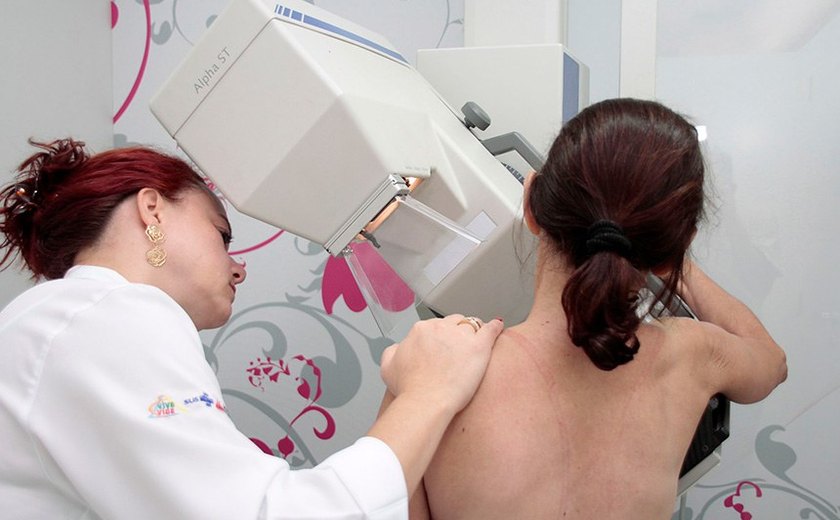 Lei garante mamografia pelo SUS a mulheres a partir de 40 anos