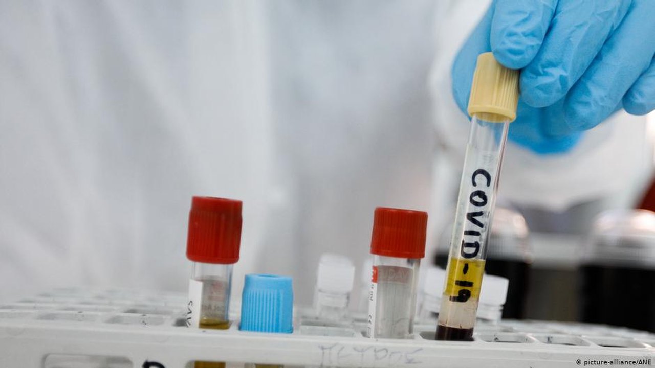 “Brasil deveria adotar rastreamento de contato de infectados para diminuir casos de Covid-19”, afirma especialista